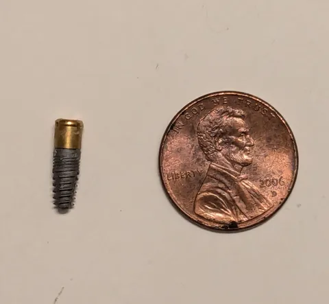 The dental implant I accidentally pulled out of my jaw. Penny for scale.