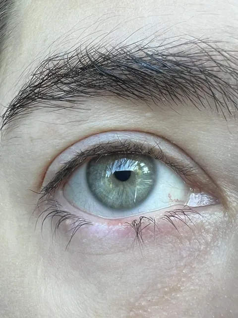 My eyelashes don’t grow in the middle of my bottom lash line