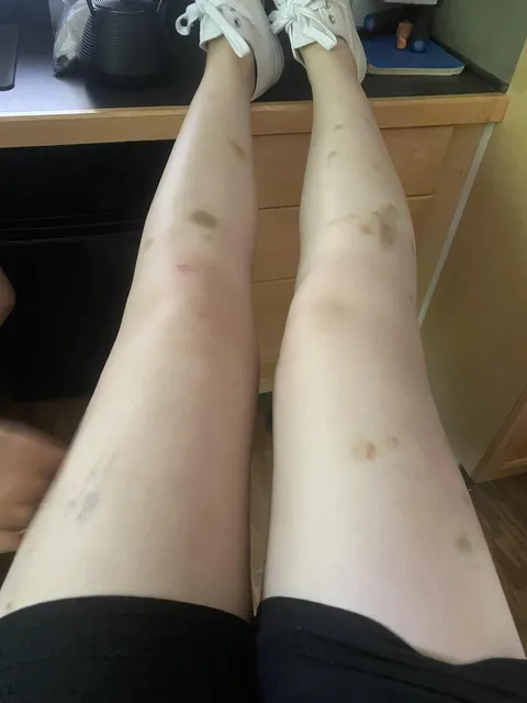 Boyfriends golden retriever paws at my legs when he wants attention