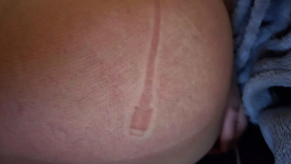 My girlfriend fell asleep on a charger cable