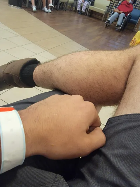 Been in the ER waiting room since 5pm, it's 5am now with no sign of being seen anytime soon. I came in with abdominal pain, and scared it's some sort of hernia or appendices. This is fucking ridiculous. Nothing but respect and compassion for the medical personnel.