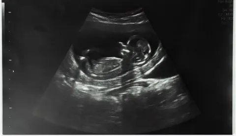 This is the cause why I didn't buy BTC in 2010