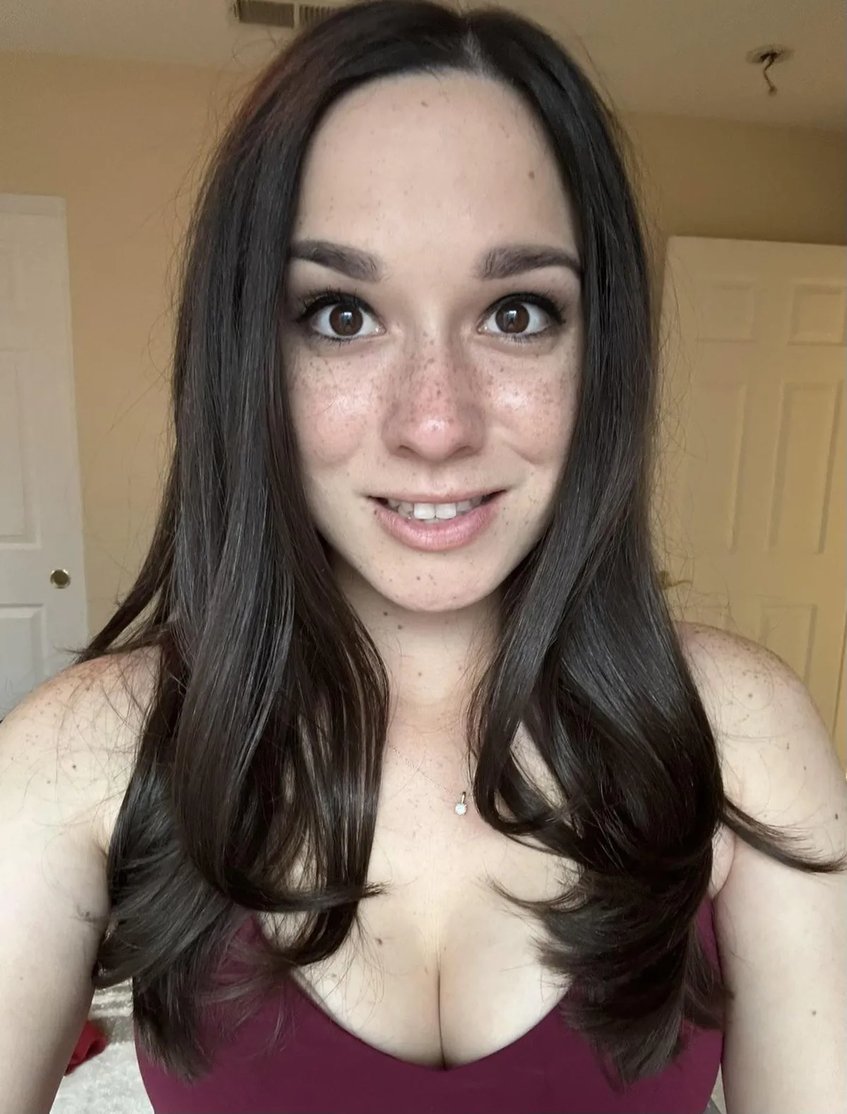 I think I get new freckles everyday.