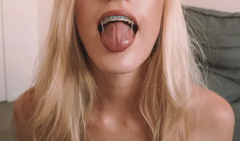 Saying ‘ahhhh’ like a good little brace face 