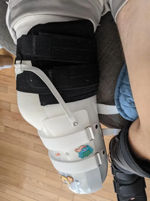 Just lost my foot after a motorcycle accident. This is the sticker my son chose to decorate my brace.