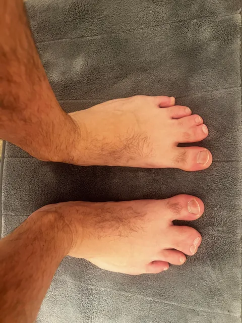 First time in 40 years revealing my webbed toes to the world!