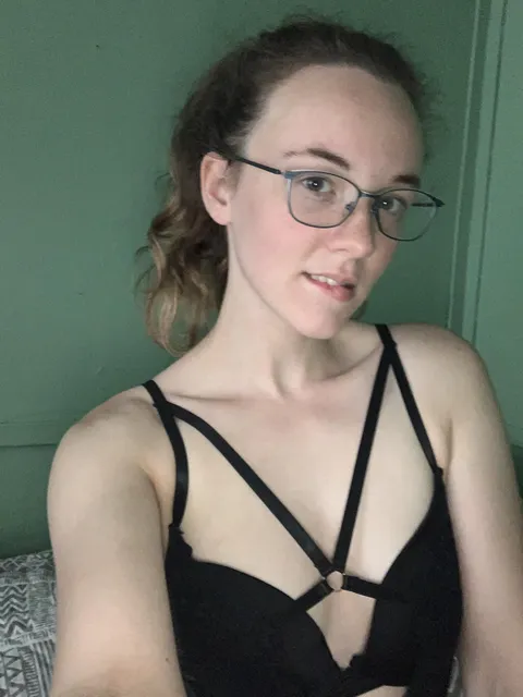 Freckles are hot