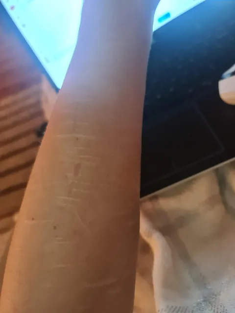 Scars cover up. by @karolinaszymanska_tattoo from Poland 🤍