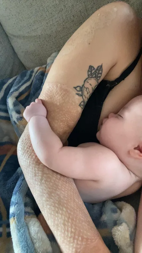 Something about seeing my baby with my skin grafts just makes me emotional. I never imagined I would experience happiness like this again. ❤️