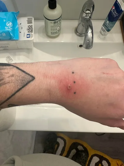 Four different doctors, a myriad of prescriptions, nonstop pain and nobody can figure out what this is.