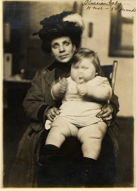 A Russian Immigrant and Her 11-month-old Baby (55lbs) at Ellis Island 1908