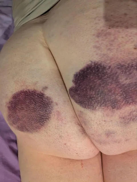 The night of and the morning after and the night after....