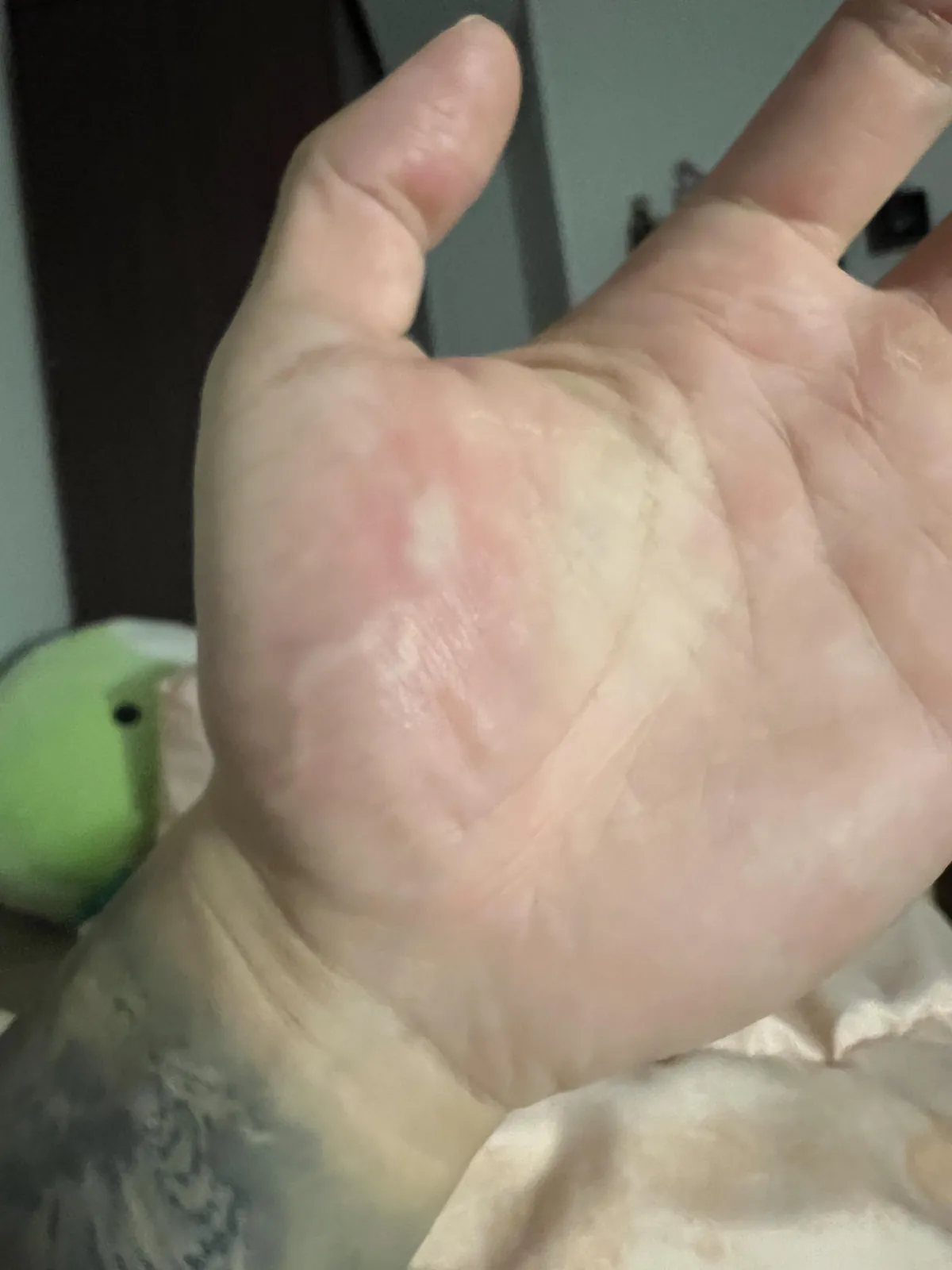 Mosquito bite traveling down my vein