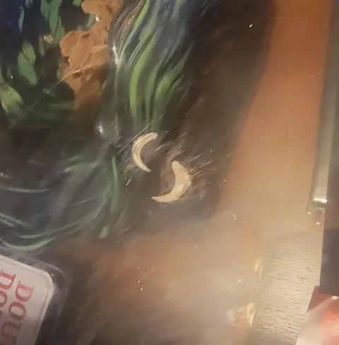 My female cat had 2 claws of my male cat embedded in her back