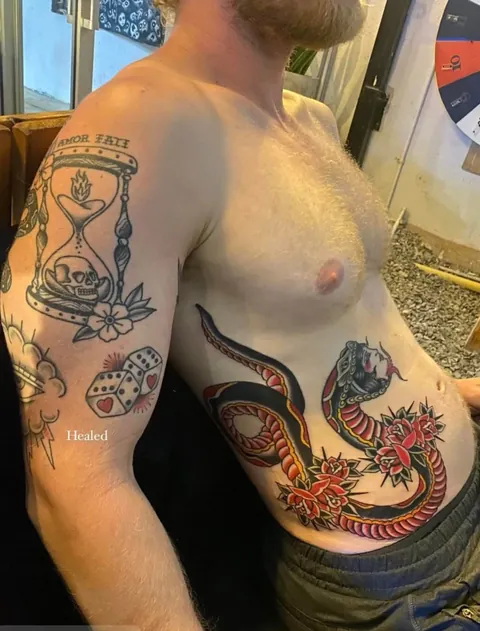 Question: has the phallacy been fixed? (3rd photo is the original)