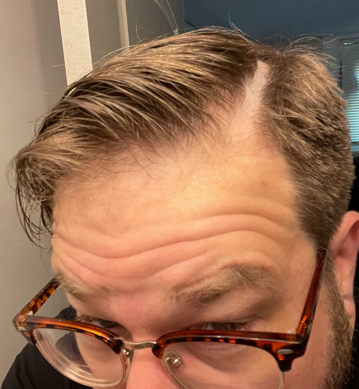 Went to a new barber. Asked for my part to be cut in. SHE MOWED A FUCKING 1/2” STRIPE OUT OF MY HEAD!