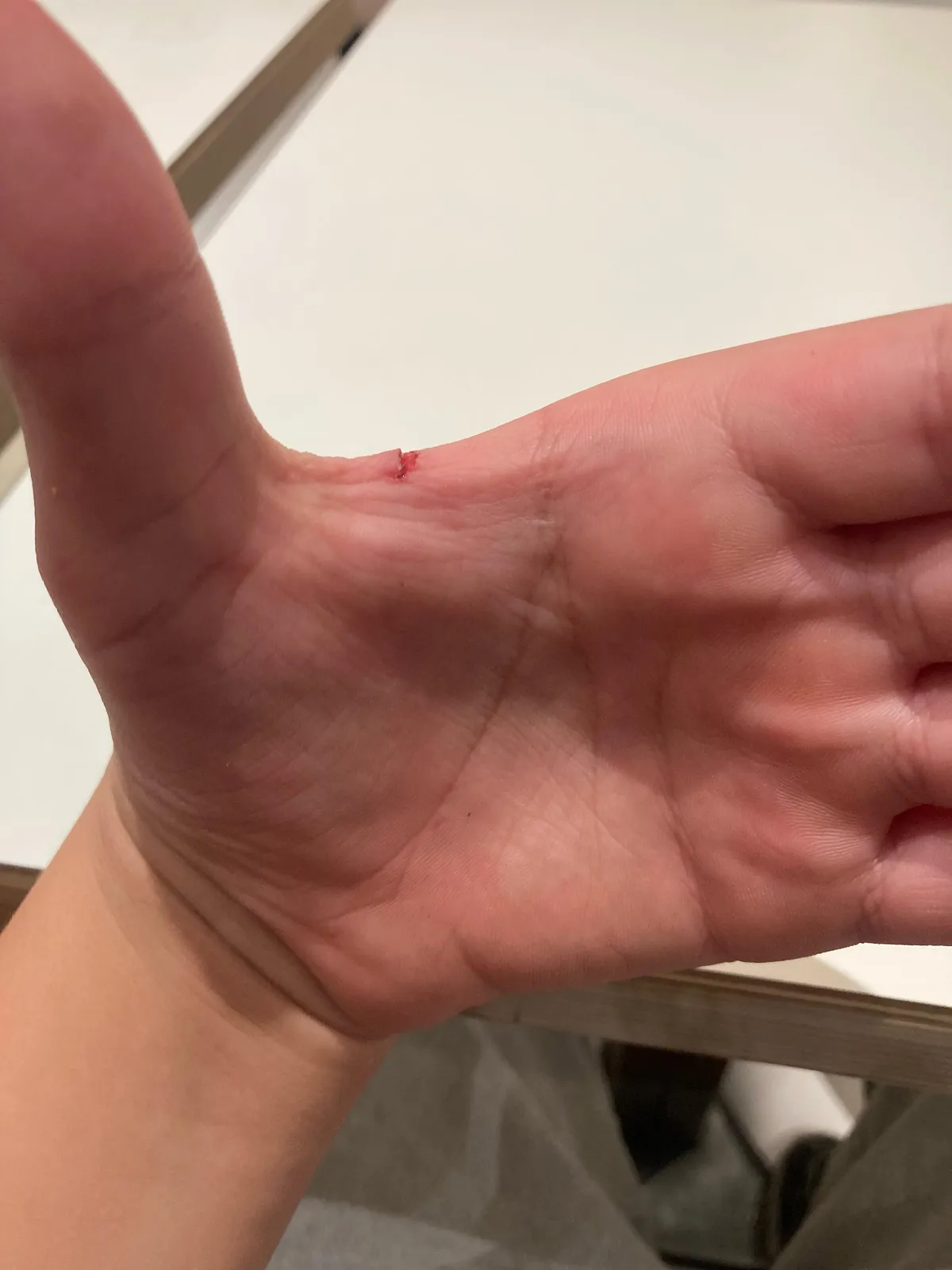 Cut my hand in the most annoying place