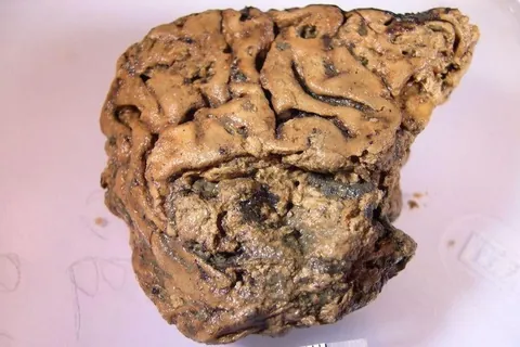The 2,600-year-old "Heslington Brain" – A biological anomaly found inside a severed Iron Age skull in Yorkshire, UK.