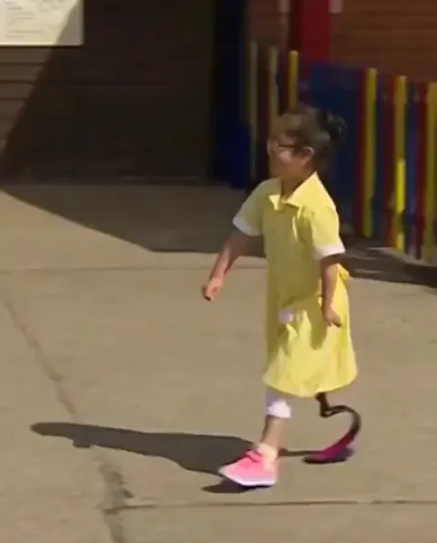 A little girl showing her new prosthetic leg to her classmates and their amazing reactions ♥️ Joy and support shine brightest when shared with others