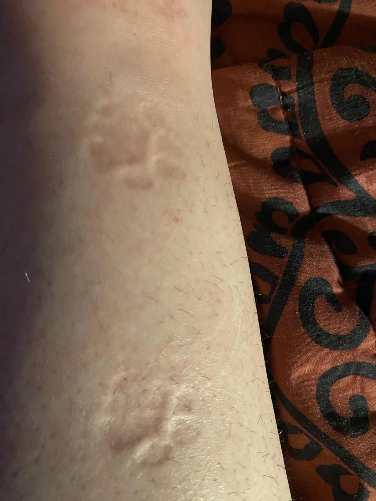 My cat left her footprints on my leg