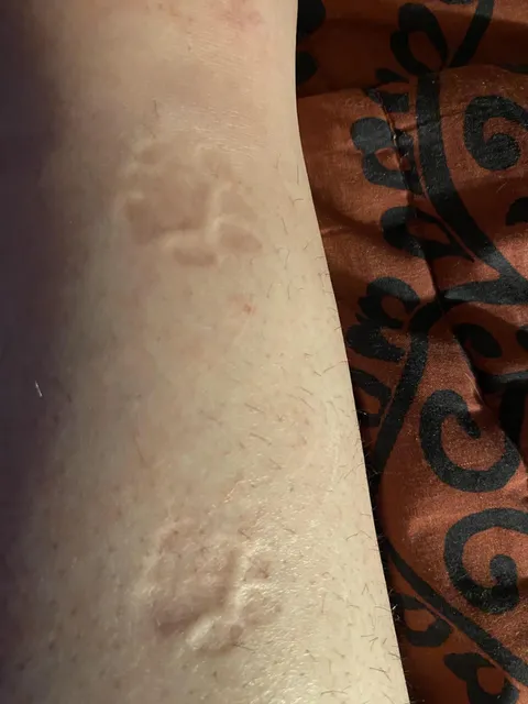 My cat left her footprints on my leg