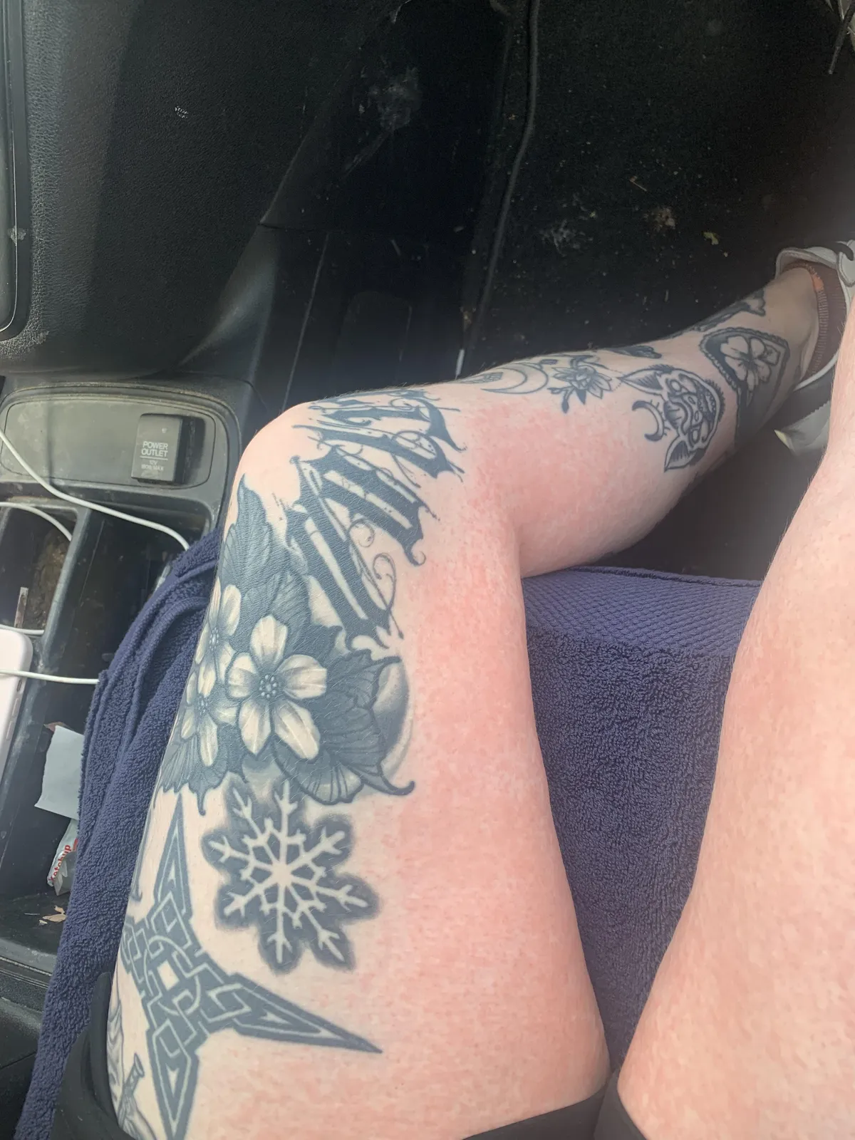 My full body allergic rash “went around” all my tattoos
