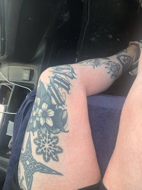 My full body allergic rash “went around” all my tattoos