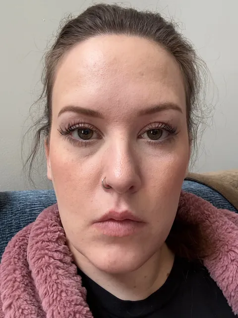 Took a year but I fixed my skin