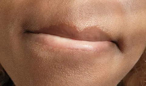literally what do i do about my lip line????