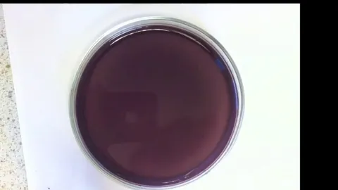 Belousov-Zhabotinsky Reaction; hands down one of the most visually stunning chemical reactions.