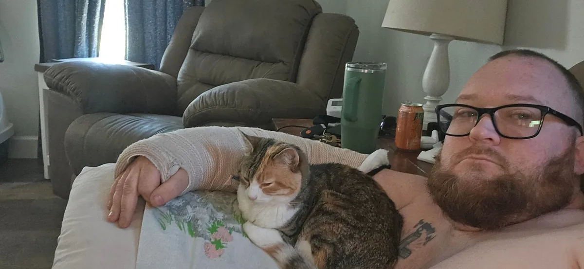 She wont leave my side since i shatteredcmy elbow