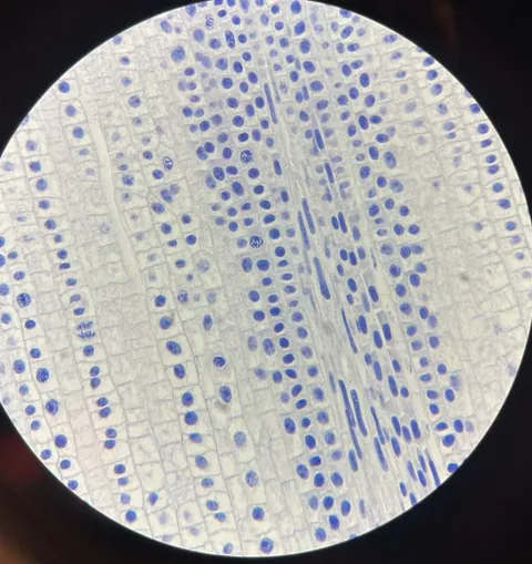 What's going on with these onion root tip cells?