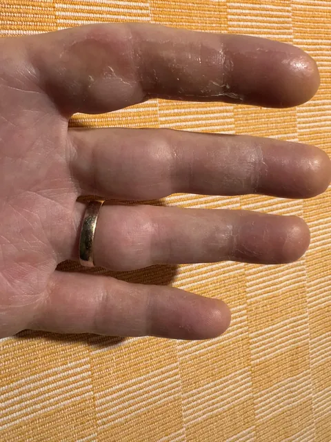 I just cut open a butternut squash and the skin is going crazy