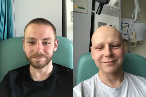 The difference three months of hardcore chemotherapy makes!