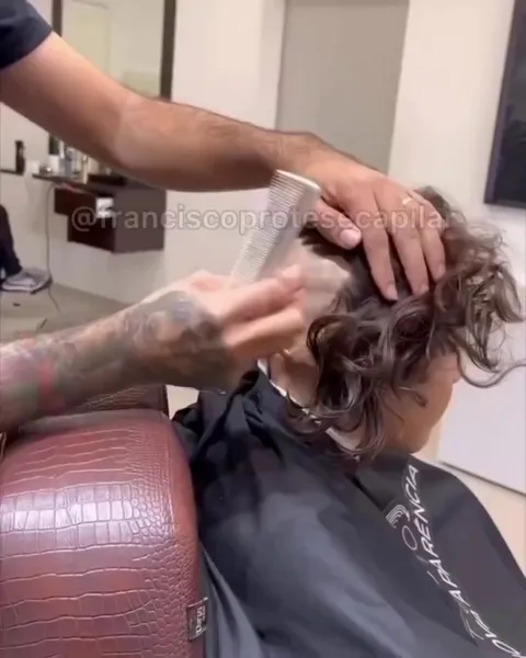  Making people smile with hair prosthesis