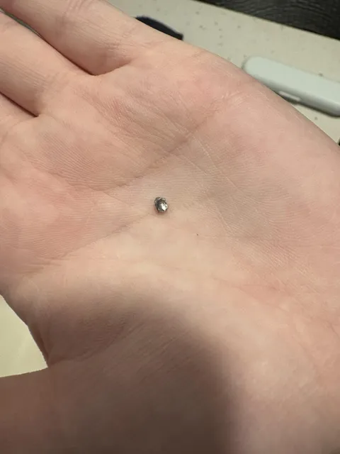 Piece of metal that was stuck on top of one of my wife’s back teeth after eating spaghetti