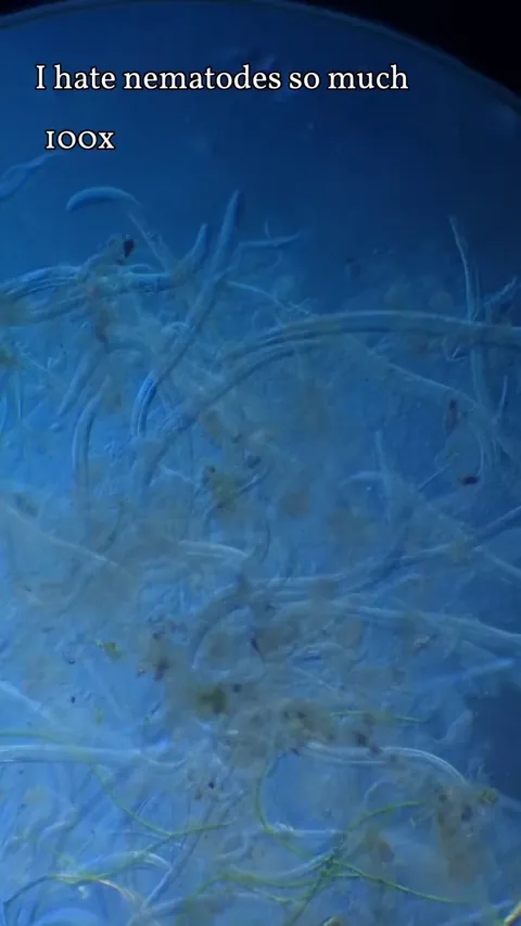 I took a sample from one of my water jars, looked into the microscope, and saw this nightmare fuel