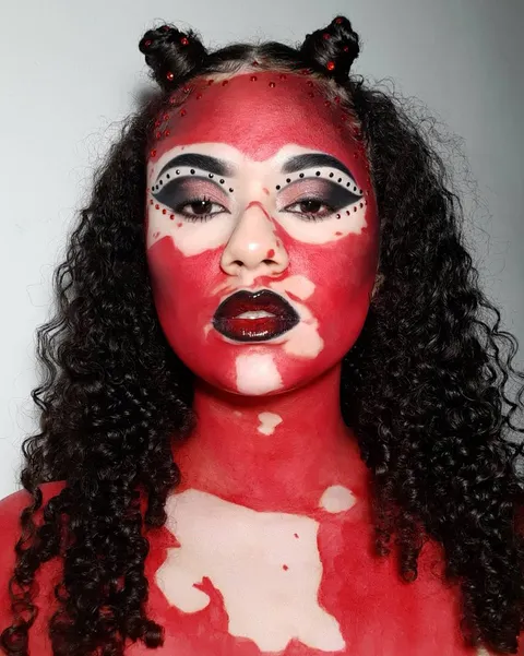 Happy Halloween from your vitiligo devil!