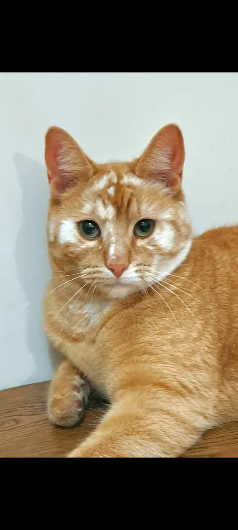 Before VS After vitiligo