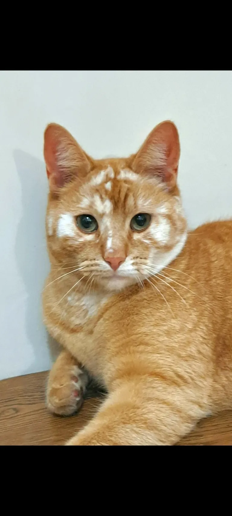 Before VS After vitiligo