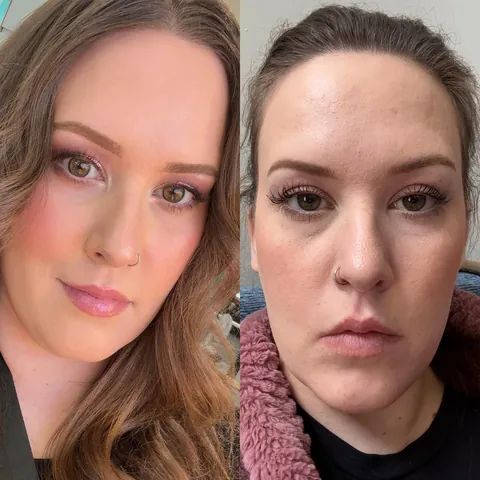 Took a year but I fixed my skin