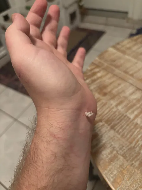 My cat shed an entire claw in my wrist
