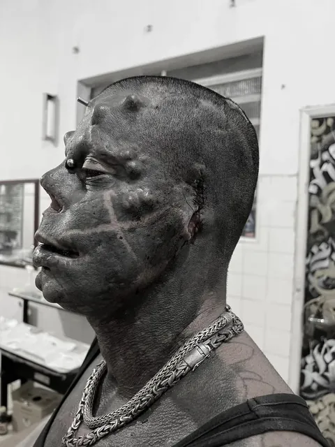 [Sensitive Content] Michel Praddo, known as "Diabão" (big devil), celebrated the end of the mask mandate by completely removing his ears. Around 85% of his body is covered in ink, he turns 50 later this year.