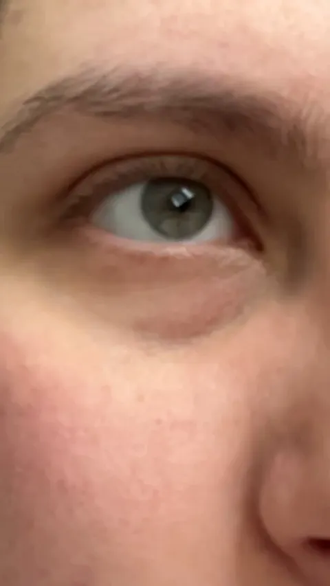 My under eye has been twitching non stop for 3 days straight