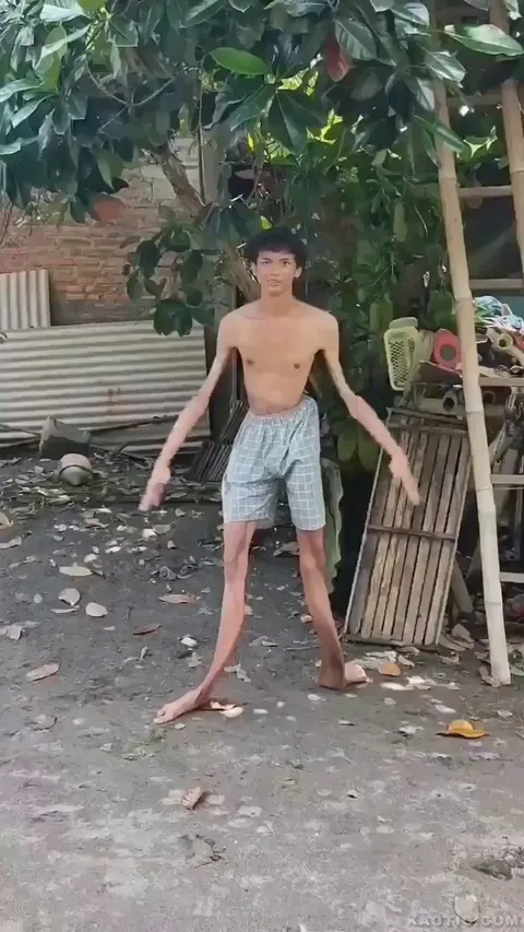 Can anyone please educate me on this condition?