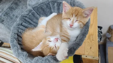 Born with no EyeBalls (anophthalmia)... My Beauty Queen