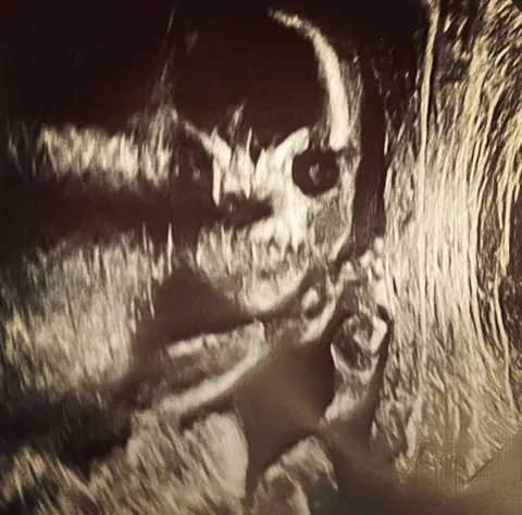 my sons ultrasound
