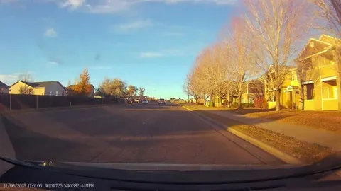 My accident from a few weeks ago [oc]