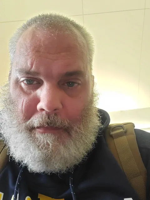 I figured you people would know. Is there a makeup that would help me cover my scar? I'm rather self conscious of it and I'm tired of it being the first thing people notice.