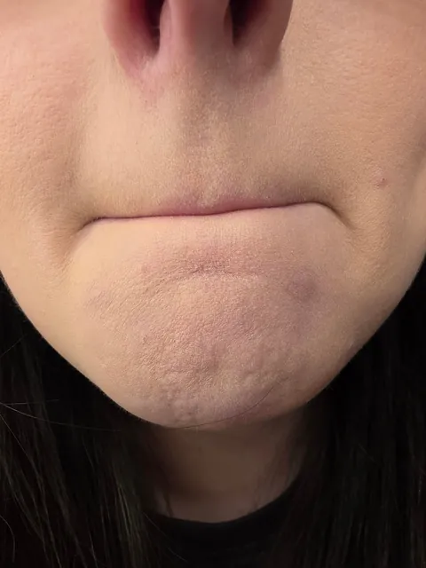 At my wits end with caking/creasing